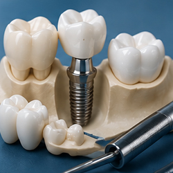 Prosthodontics