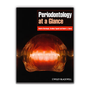 periodontology at a glance