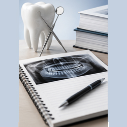 Dental Exam