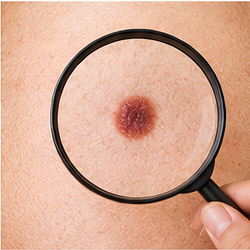 Dermatology