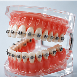 Orthodontics