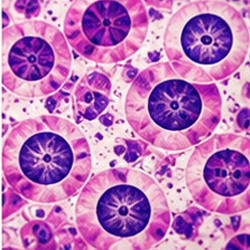 Pathology