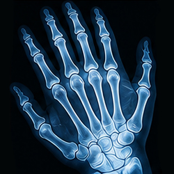 Radiography